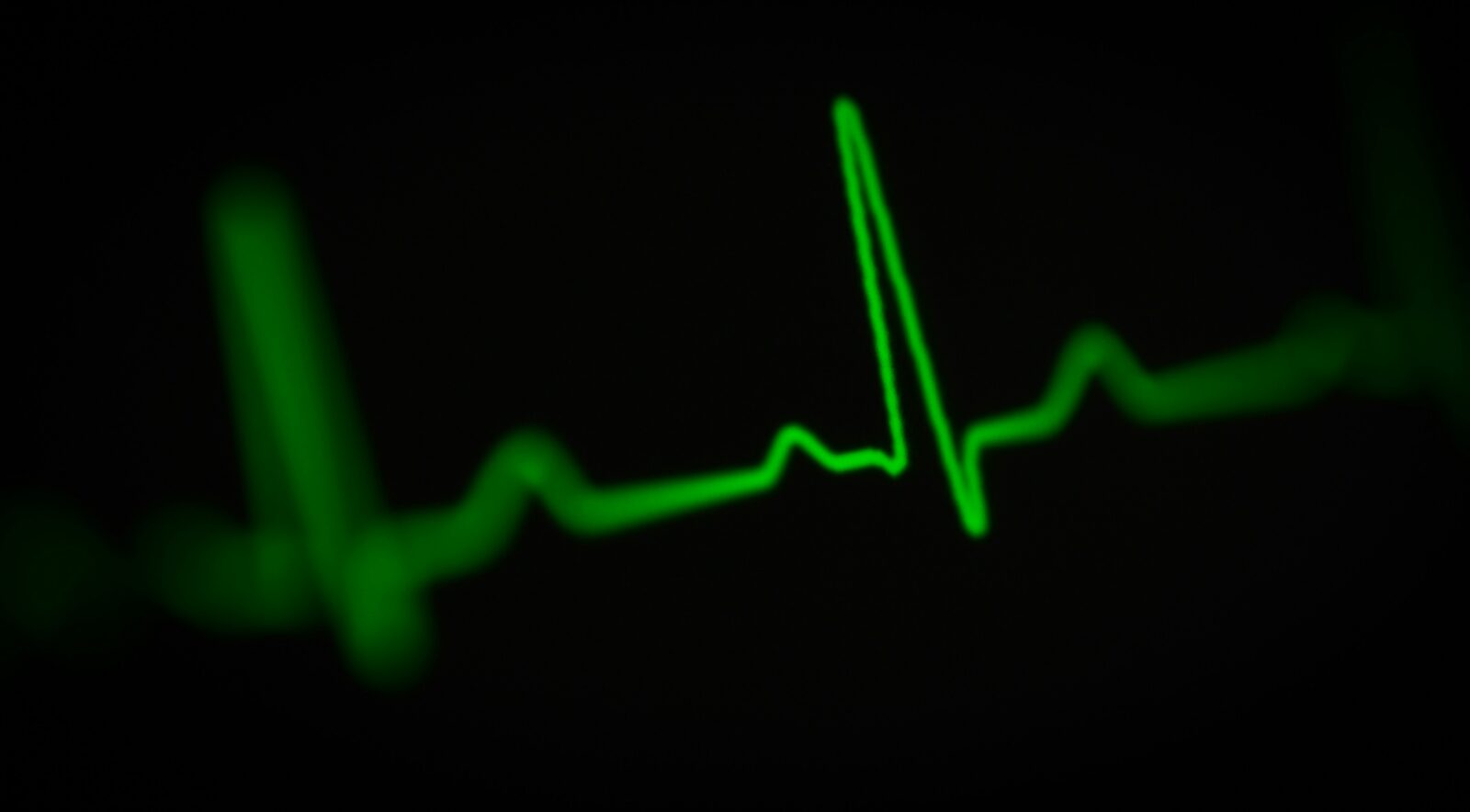 ekg measurement